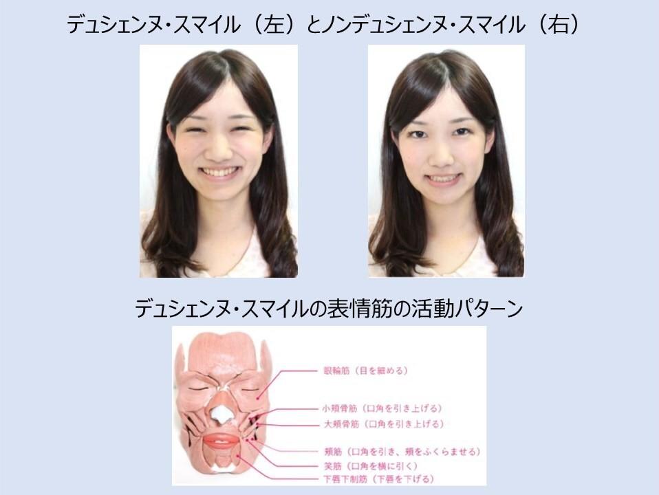 デュシエンヌスマイル